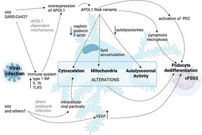 Collapsing Focal Segmental Glomerulosclerosis in Viral Infections